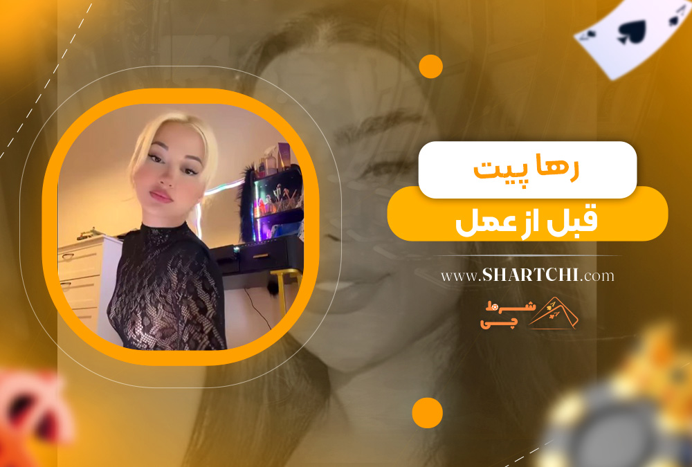 رها پیت قبل از عمل